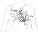 Fig. 01 - DEVICE FOR THE DEFIBRILLATION OF THE HEART