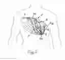 Fig. 06 - DEVICE FOR THE DEFIBRILLATION OF THE HEART