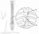Fig. 01 - METHODS AND APPARATUS FOR SPINAL CORD STIMULATION USING EXPANDABLE ELECTRODE