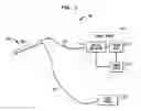 Fig. 02 - METHODS AND APPARATUS FOR SPINAL CORD STIMULATION USING EXPANDABLE ELECTRODE