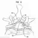 Fig. 08 - METHODS AND APPARATUS FOR SPINAL CORD STIMULATION USING EXPANDABLE ELECTRODE