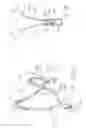 Fig. 28 - Implantable vascular device