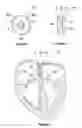 Fig. 02 - Devices and methods for the treatment of heart failure