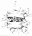 Fig. 01 - Universal Spinal Disc Implant System