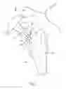 Fig. 02 - Joint prosthesis having infinitely adjustable head