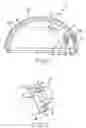 Fig. 02 - PLUG FOR COVERING SCREW HOLES IN PROSTHETIC IMPLANTS