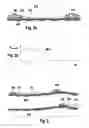 Fig. 03 - METHOD FOR RECOGNIZING A VERTICAL MISALIGNMENT OF A RADAR SENSOR