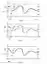 Fig. 07 - System and method for variable text-to-speech with minimized distraction to operator of an automotive vehicle