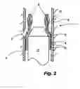 Fig. 03 - Cladding method and expansion tool