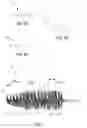 Fig. 03 - Mascara brush including bristles of various diameters