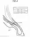 Fig. 05 - Pneumatic radial tire for heavy load