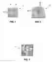 Fig. 06 - Methods of repairing a substrate