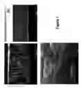 Fig. 02 - Nanostructured metal-polyaniline composites and applications thereof