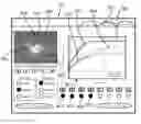 Fig. 01 - Medical systems and methods