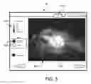Fig. 04 - Medical systems and methods