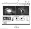 Fig. 08 - Medical systems and methods