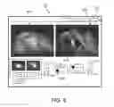 Fig. 09 - Medical systems and methods