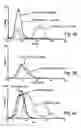 Fig. 04 - Antibodies for selective apoptosis of cells
