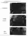 Fig. 04 - Use of tellurium containing compounds as nerve protecting agents