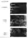 Fig. 06 - Use of tellurium containing compounds as nerve protecting agents