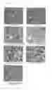 Fig. 04 - Pharmaceutical composition comprising metadoxine and garlic oil for preventing and treating alcohol-induced fatty liver and steatohepatitis