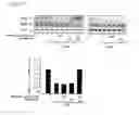 Fig. 08 - Pharmaceutical composition comprising metadoxine and garlic oil for preventing and treating alcohol-induced fatty liver and steatohepatitis
