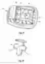 Fig. 08 - Self-ligating orthodontic bracket assembly