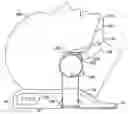 Fig. 01 - Positioning device for use with a patient under anesthesia and associated methods