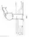 Fig. 03 - Positioning device for use with a patient under anesthesia and associated methods