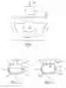 Fig. 02 - PREFORMED MALLEABLE MULTILAYER DENTAL ARTICLES