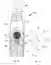 Fig. 02 - DEVICE PROVIDING AN INTERFACE BETWEEN A DENTAL IMPLANT AND AN ABUTMENT