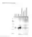 Fig. 16 - Methods of diagnosing endometriosis in human subjects using the ME-5 polypeptide