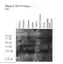 Fig. 17 - Methods of diagnosing endometriosis in human subjects using the ME-5 polypeptide