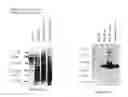 Fig. 18 - Methods of diagnosing endometriosis in human subjects using the ME-5 polypeptide