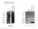 Fig. 20 - Methods of diagnosing endometriosis in human subjects using the ME-5 polypeptide