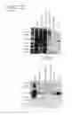 Fig. 22 - Methods of diagnosing endometriosis in human subjects using the ME-5 polypeptide