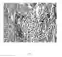 Fig. 06 - COMPOSITIONS AND METHODS TO REDUCE FAT AND RETRACT SKIN