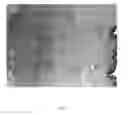 Fig. 07 - COMPOSITIONS AND METHODS TO REDUCE FAT AND RETRACT SKIN