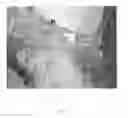 Fig. 08 - COMPOSITIONS AND METHODS TO REDUCE FAT AND RETRACT SKIN