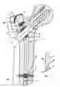 Fig. 02 - Device for bone fixation