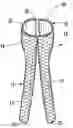Fig. 01 - BIFURCATED MEDICAL DEVICE FOR TREATING A TARGET SITE AND ASSOCIATED METHOD