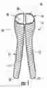 Fig. 02 - BIFURCATED MEDICAL DEVICE FOR TREATING A TARGET SITE AND ASSOCIATED METHOD