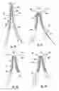 Fig. 08 - BIFURCATED MEDICAL DEVICE FOR TREATING A TARGET SITE AND ASSOCIATED METHOD
