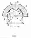 Fig. 02 - Wear-reducing geometry of articulations in total joint replacements