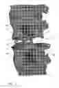 Fig. 02 - VERTEBRAL DISK PROSTHESIS AND SET OF ELEMENTS FOR THE CONSTITUTION OF A VERTEBRAL DISK PROSTHESIS