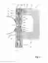 Fig. 03 - Auxiliary handle for hand-held power tool