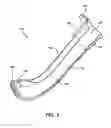 Fig. 04 - Temporary pharyngeal airway