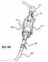 Fig. 11 - Non-invasive scanning apparatuses
