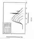 Fig. 07 - Orthovoltage radiotherapy