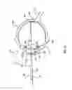 Fig. 04 - Orthovoltage radiotherapy